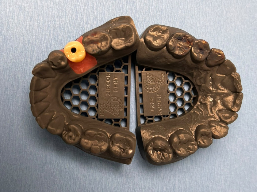 Dental implant procedure step 3 – scanning and preparation for the permanent crown