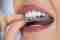 Ortodoncie Smile Centrum Stomatologie