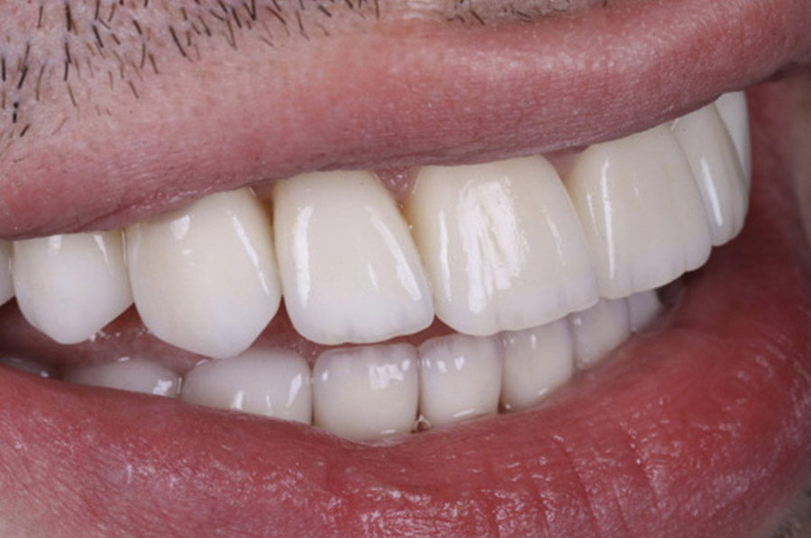 Дентальна гігієна
