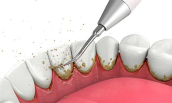 Domácí péče a dentální hygiena pro krásný úsměv