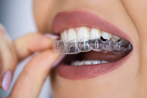Ortodoncie Smile Centrum Stomatologie